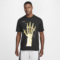 Kobe 'X-Ray'